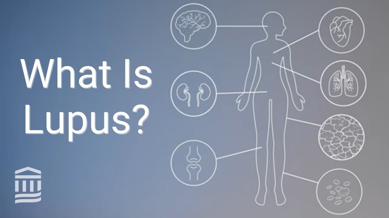 Νέα πειραματική θεραπεία για τον λύκο μειώνει θεαματικά τα συμπτώματα σε ποντίκια