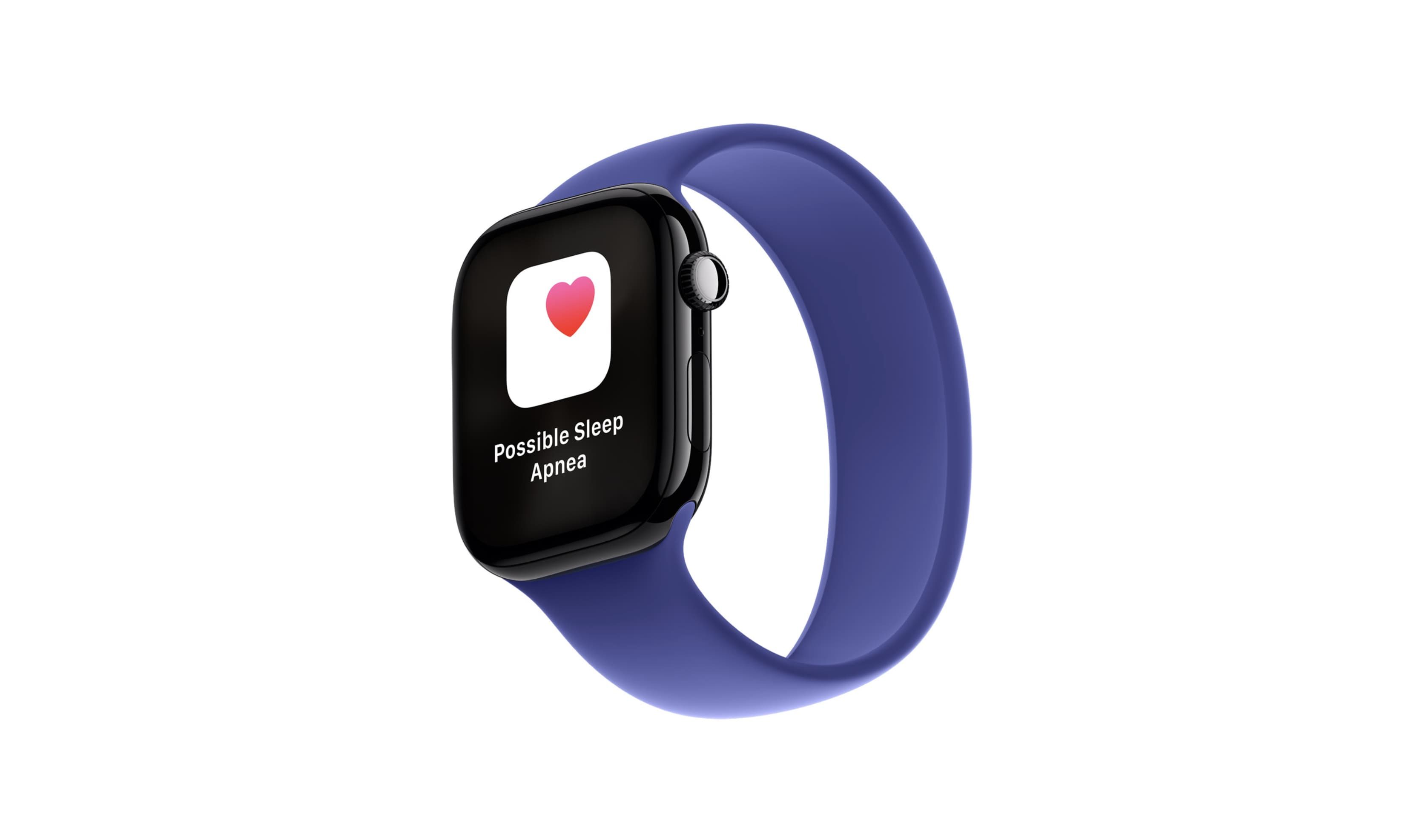 Apple Watch: Κυριαρχία σχεδόν απόλυτη στα Edge AI smartwatches το α’ τρίμηνο του 2026